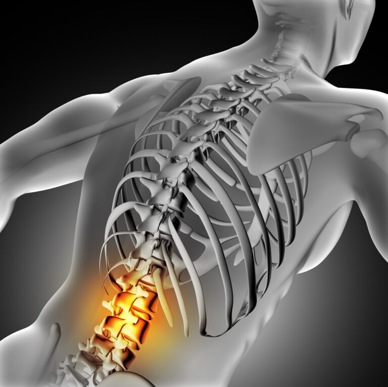 A SulAmérica Saúde é obrigada a custear cirurgia de coluna?