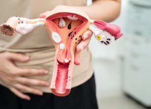 Endometriose profunda: plano de saúde deve cobrir a cirurgia especializada?