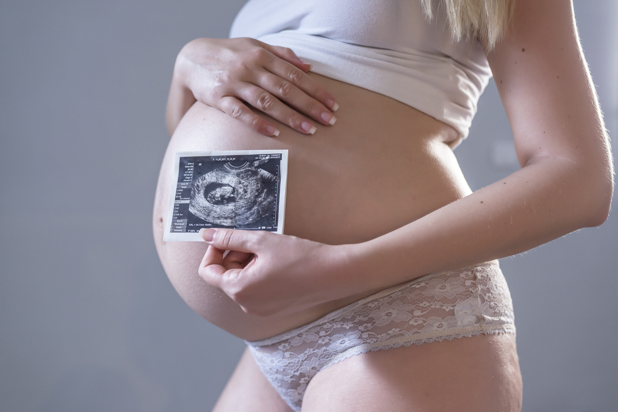 plano de saúde deve custear cirurgia intrauterina