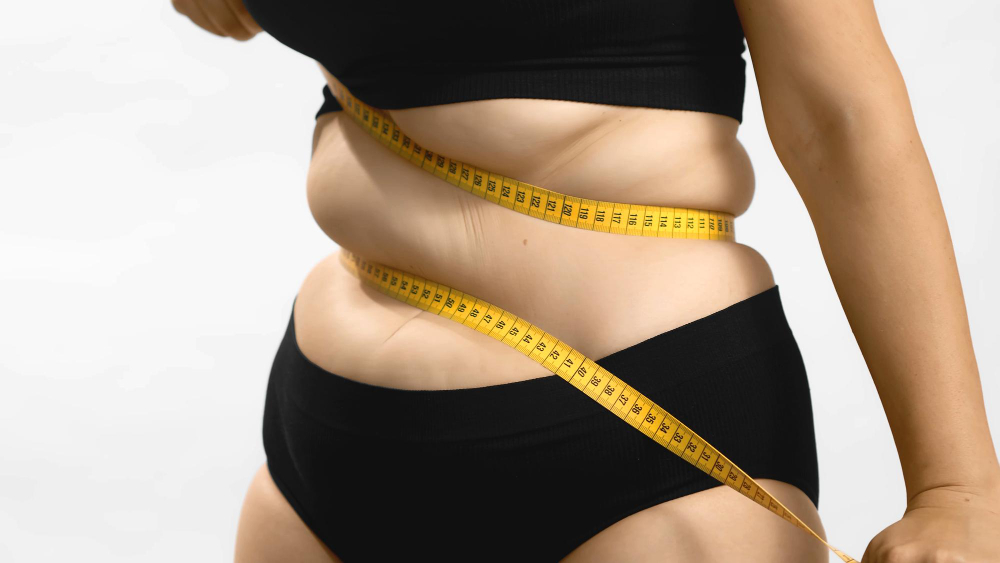 Cirurgia Bariátrica deve ser custeada pelo Plano de Saúde?