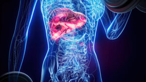 Pancreatectomia deve ser custeada pelo Plano de Saúde?